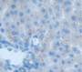 Delta Like Protein 4 (Dll4) Polyclonal Antibody, Cat#CAU21769