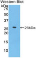 Western Blot; Sample: Recombinant protein.