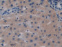 DAB staining on IHC-P; Samples: Human Liver Tissue; Primary Ab: 15µg/ml Rabbit Anti-Human BGN Antibody Second Ab: 2µg/mL HRP-Linked Caprine Anti-Rabbit IgG Polyclonal Antibody