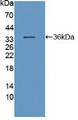 Western Blot; Sample: Recombinant DNAH11, Human.