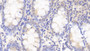DAB staining on IHC-P; Samples: Human Colon Tissue;  Primary Ab: 20μg/ml Rabbit Anti-Human DYRK1A Antibody Second Ab: 2µg/mL HRP-Linked Caprine Anti-Rabbit IgG Polyclonal Antibody 