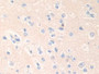 DAB staining on IHC-P; Samples: Human Cerebrum Tissue;  Primary Ab: 10µg/ml Rabbit Anti-Human EPN1 A