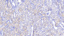 DAB staining on IHC-P; Samples: Human Kidney Tissue;  Primary Ab: 20μg/ml Rabbit Anti-Human FAH Antibody Second Ab: 2µg/mL HRP-Linked Caprine Anti-Rabbit IgG Polyclonal Antibody 