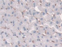 DAB staining on IHC-P; Samples: Human Liver Tissue;  Primary Ab: 10µg/ml Rabbit Anti-Human FcgRT Ant