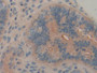 DAB staining on fromalin fixed paraffin-embedded lung tissue)