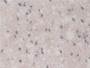 DAB staining on IHC-P; Samples: Human Glioma Tissue; Primary Ab: 30µg/ml Rabbit Anti-Human FIS1 Antibody Second Ab: 2µg/mL HRP-Linked Caprine Anti-Rabbit IgG Polyclonal Antibody