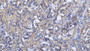 DAB staining on IHC-P; Samples: Human Stomach Tissue; Primary Ab: 20µg/ml Rabbit Anti-Human GKN2 Antibody Second Ab: 2µg/mL HRP-Linked Caprine Anti-Rabbit IgG Polyclonal Antibody