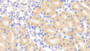 DAB staining on fromalin fixed paraffin- embedded brain tissue)