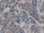 DAB staining on fromalin fixed paraffin-embedded liver tissue)