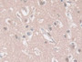 DAB staining on fromalin fixed paraffin- embedded liver tissue)