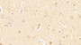 DAB staining on IHC-P; Samples: Human Cerebrum Tissue; Primary Ab: 20μg/ml Rabbit Anti-Human HAP1 Antibody Second Ab: 2µg/mL HRP-Linked Caprine Anti-Rabbit IgG Polyclonal Antibody