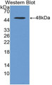 Western Blot; Sample: Recombinant protein.