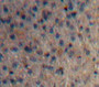 Used in DAB staining on fromalin fixed paraffin-embedded Liver tissue