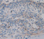 Hornerin (Hrnr) Polyclonal Antibody, Cat#CAU21840