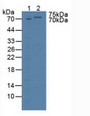 Western Blot; Sample: Lane1: Human HepG2 Tissue; Lane2: Human Lung Tissue.