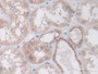 DAB staining on IHC-P; Samples: Human Kidney Tissue; Primary Ab: 10µg/ml Rabbit Anti-Human IDH2 Antibody Second Ab: 2µg/mL HRP-Linked Caprine Anti-Rabbit IgG Polyclonal Antibody