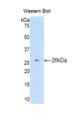 Western Blot; Sample: Recombinant protein.