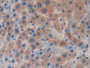DAB staining on IHC-P; Samples: Rat Liver Tissue; Primary Ab: 30µg/ml Rabbit Anti-Rat IL18BP Antibody Second Ab: 2µg/mL HRP-Linked Caprine Anti-Rabbit IgG Polyclonal Antibody