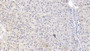 DAB staining on IHC-P; Samples: Human Liver Tissue; Primary Ab: 20µg/ml Rabbit Anti-Human IL18BP Antibody Second Ab: 2µg/mL HRP-Linked Caprine Anti-Rabbit IgG Polyclonal Antibody