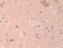 DAB staining on IHC-P; Samples: Human Cerebrum Tissue; Primary Ab: 10µg/ml Rabbit Anti-Human IL1RAPL2 Antibody Second Ab: 2µg/mL HRP-Linked Caprine Anti-Rabbit IgG Polyclonal Antibody