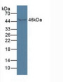 Western Blot; Sample:Human Serum.