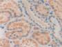 DAB staining on IHC-P; Samples: Human Kidney Tissue; Primary Ab: 20µg/ml Rabbit Anti-Human ISLR Antibody Second Ab: 2µg/mL HRP-Linked Caprine Anti-Rabbit IgG Polyclonal Antibody