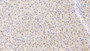 DAB staining on IHC-P; Samples: Human Liver Tissue;  Primary Ab: 30µg/ml   Rabbit Anti-Human ITIH4 Antibody Second Ab: 2µg/mL HRP-Linked Caprine Anti-Rabbit IgG Polyclonal Antibody 