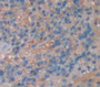 Il2 Inducible T-Cell Kinase (Itk) Polyclonal Antibody, Cat#CAU21882