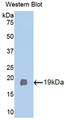 Western Blot; Sample: Recombinant protein.