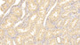 DAB staining on IHC-P; Samples: Human Kidney Tissue;  Primary Ab: 20μg/ml Rabbit Anti-Human LMAN2 Antibody Second Ab: 2µg/mL HRP-Linked Caprine Anti-Rabbit IgG Polyclonal Antibody 