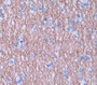 Lymphocyte Adaptor Protein (Lnk) Polyclonal Antibody, Cat#CAU21894