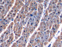 DAB staining on IHC-P; Samples: Human Cardiac Muscle Tissue; Primary Ab: 10µg/ml Rabbit Anti-Human MDH2 Antibody Second Ab: 2µg/mL HRP-Linked Caprine Anti-Rabbit IgG Polyclonal Antibody