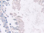 DAB staining on IHC-P; Samples: Rat Testis Tissue; Primary Ab: 30µg/ml Rabbit Anti-Rat METRN Antibody Second Ab: 2µg/mL HRP-Linked Caprine Anti-Rabbit IgG Polyclonal Antibody