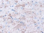 DAB staining on IHC-P; Samples: Mouse Cerebrum Tissue; Primary Ab: 10µg/ml Rabbit Anti-Mouse METRN Antibody Second Ab: 2µg/mL HRP-Linked Caprine Anti-Rabbit IgG Polyclonal Antibody