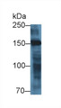 Western Blot; Sample: Porcine Heart lysate; Primary Ab: 1µg/ml Rabbit Anti-Human MYOM2 Antibody Second Ab: 0.2µg/mL HRP-Linked Caprine Anti-Rabbit IgG Polyclonal Antibody