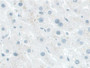 DAB staining on IHC-P; Samples: Human Liver Tissue;  Primary Ab: 10µg/ml Rabbit Anti-Human NADK Anti