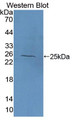 Western Blot; Sample: Recombinant protein.