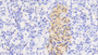 DAB staining on IHC-P. Samples: Human Tissue)