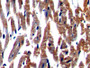 DAB staining on IHC-P; Samples: Rat Cardiac Muscle Tissue)