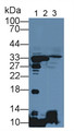 Western Blot; Sample: Lane1: Mouse Liver lysate; Lane2: Mouse Mastadenoma lysate; Lane3: Mouse Small intestine lysate; Primary Ab: 1µg/mL Rabbit Anti-Mouse NNMT Antibody; Second Ab: 0.2µg/mL HRP-Linked Caprine Anti-Rabbit IgG Polyclonal Antibody;