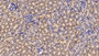 Nicotinamide-N-Methyltransferase (Nnmt) Polyclonal Antibody, Cat#CAU21946