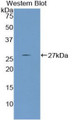 Western Blot; Sample: Recombinant protein.