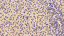 DAB staining on fromalin fixed paraffin- embedded Kidney tissue)