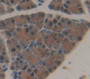 Neuropathy Target Esterase (Nte) Polyclonal Antibody, Cat#CAU21951