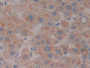 DAB staining on IHC-P; Samples: Human Liver Tissue; Primary Ab: 10µg/ml Rabbit Anti-Human NXN Antibody Second Ab: 2µg/mL HRP-Linked Caprine Anti-Rabbit IgG Polyclonal Antibody