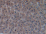 DAB staining on IHC-P; Samples: Rat Liver Tissue; Primary Ab: 20µg/ml Rabbit Anti-Rat OCM Antibody Second Ab: 2µg/mL HRP-Linked Caprine Anti-Rabbit IgG Polyclonal Antibody