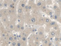 DAB staining on IHC-P; Samples: Human Liver Tissue; Primary Ab: 20µg/ml Rabbit Anti-Human OXCT1 Antibody Second Ab: 2µg/mL HRP-Linked Caprine Anti-Rabbit IgG Polyclonal Antibody