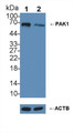 Knockout Varification: ; Lane 1: Wild-type Hela cell lysate; ; Lane 2: PAK1 knockout Hela cell lysate; ; Predicted MW: 61kd ; Observed MW: 65kd; Primary Ab: 3µg/ml Rabbit Anti-Human PAK1 Antibody; Second Ab: 0.2µg/mL HRP-Linked Caprine Anti-Rabbit IgG Polyclonal Antibody;