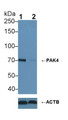 Knockout Varification: &lt;br/&gt;Lane 1: Wild-type Hela cell lysate; &lt;br/&gt;Lane 2: PAK4 knockout Hela cell lysate; &lt;br/&gt;Predicted MW: 64kDa &lt;br/&gt;Observed MW: 70kDa&lt;br/&gt;Primary Ab: 1µg/ml Rabbit Anti-Human PAK4 Antibody&lt;br/&gt;Second Ab: 0.2µg/mL HRP-Linked Caprine Anti-Rabbit IgG Polyclonal Antibody&lt;br/&gt;