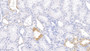 DAB staining on IHC-P; Samples: Human Kidney Tissue;  Primary Ab: 10µg/ml Rabbit Anti-Human PBRM1 Antibody Second Ab: 2µg/mL HRP-Linked Caprine Anti-Rabbit IgG Polyclonal Antibody 